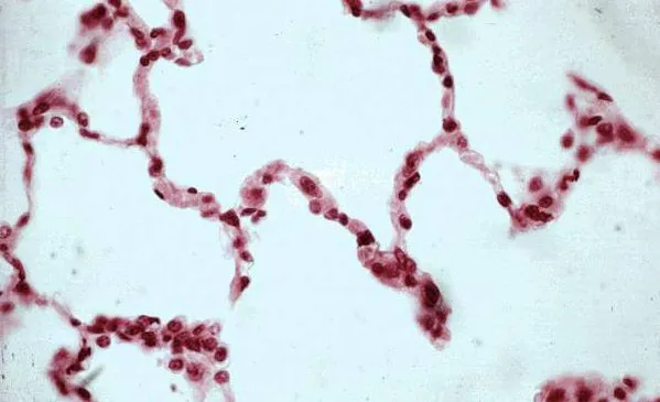 Сквамозные клетки под микроскопом мазка