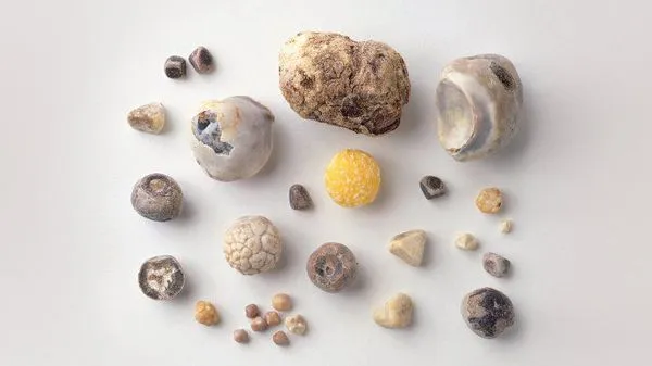 Типы образовавшихся камней