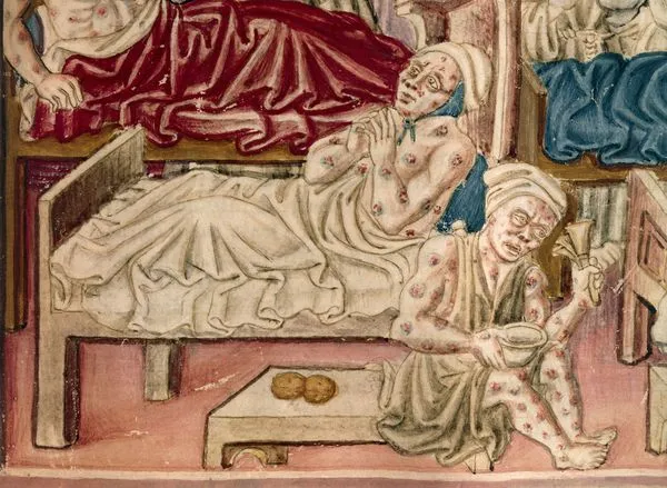 Больной чумой (средневековая картина).