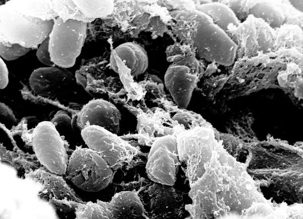 Бактерия чумы, электронная микрофотография