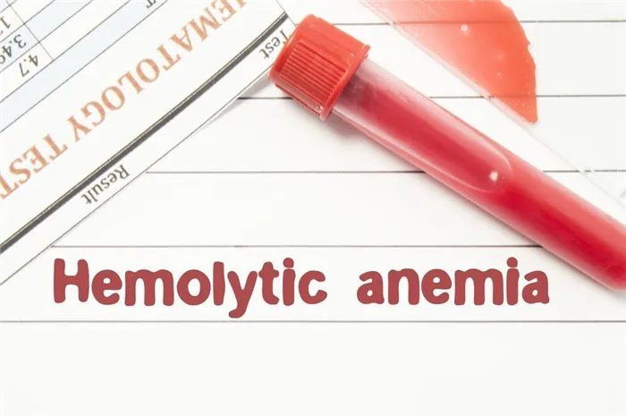 Как выглядит гемолитическая анемия?