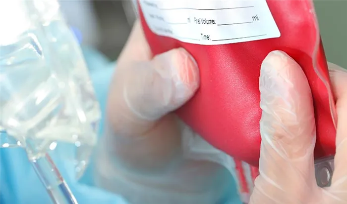 переливание крови и кровекомпонентов в Москве