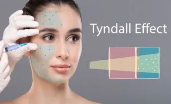 Эффект Тиндаля в косметологии под глазами, на коже губ. Когда наблюдается, как убрать