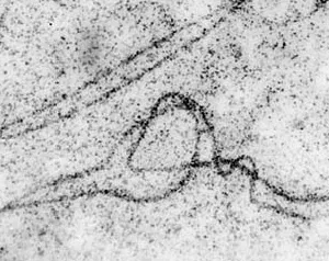 Рис. 7. Фрагмент синаптонемного комплекса, несущего гетерозиготную хромосомную перестройку — инверсию, которая проявляется как типичная инверсионная петля. Фото Ю.С. Федотовой. Изображение: «Природа»