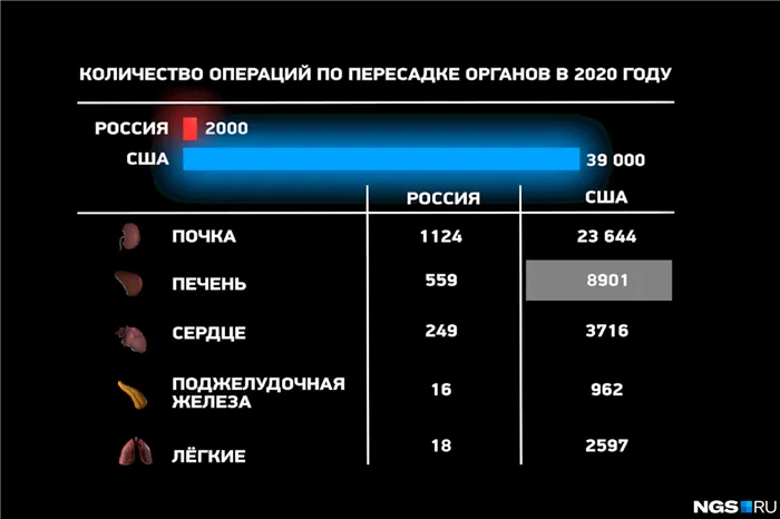 Разница в количестве пересадок в России и США — колоссальна